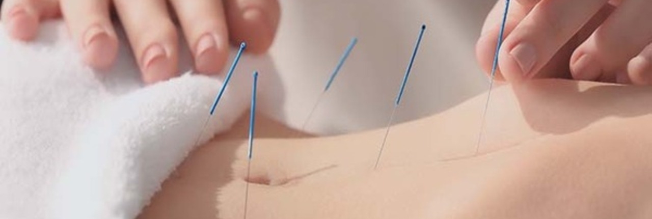 Acupuncture and pregnancy